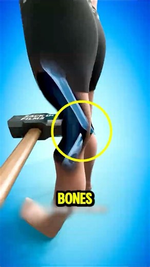 What If Your Body Had No Bones?