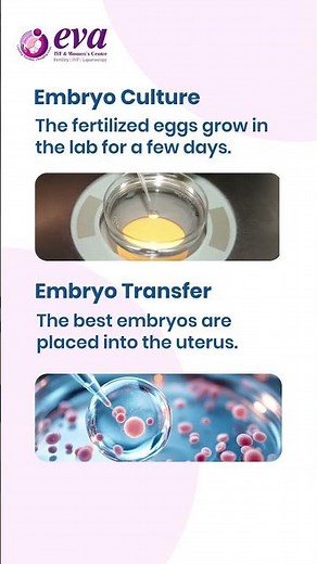 Step-by-Step IVF Procedure...!!!