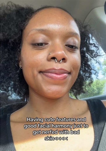 Dealing with Acne: Tips for Clearer Skin