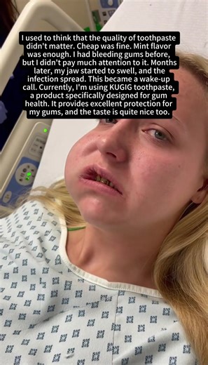 I used to think that the quality of toothpaste didn't matter. Cheap was fine. Mint flavor was enough. I had bleeding gums before, but I didn't pay much attention to it. Months later, my jaw started to swell, and the infection spread. This became a wake-up call. Currently, I'm using KUGIG toothpaste, a product specifically designed for gum health. It provides excellent protection for my gums, and the taste is quite nice too. #toothpaste #smile #teethwhiteningtechnician #oralcare #oralhealth