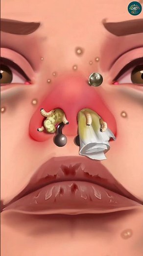 ASMR Severe Nose Infection Care👃| Pus Removal & Healing Sounds #shorts #asmr #animation #treatment