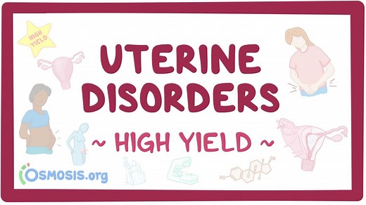 Uterine disorders: Pathology review: Video, Causes, & Meaning | Osmosis
