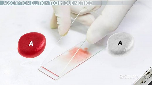 Elution Definition & Techniques