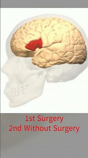 Brain ke bare me Amazing Information by Dr Deepak Agrawal | TV Health