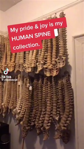 Human Bone collection. | human spine collector