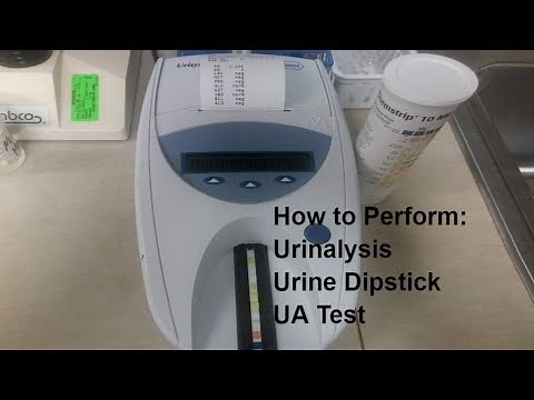 How to Perform a Urine Dipstick Test!