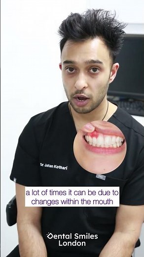 Loose Dentures? Fix It Fast! Dentist’s Quick Advice 🦷✨ #shorts