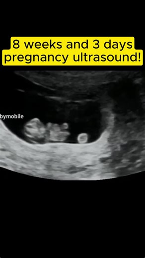 8 Weeks and 3 Days Pregnancy Ultrasound: Baby Kicks and Development