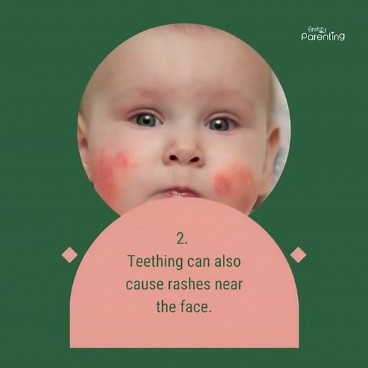 Is Your Baby Teething - Know the Signs and Remedies