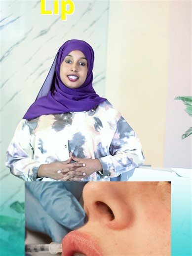 ✨ SKINVIVE – Deep Hydration Without Volume ✨ Dry or dehydrated lips but don’t want fillers? SKINVIVE is an injectable skin booster that deeply hydrates the lips and face, leaving skin smooth, soft, and naturally refreshed 💧 No added volume, no shape change — just long-lasting hydration and healthier-looking skin.✨ 📍 Dire Dawa: Sabian Ozzie Plaza, 4th Floor 📞 Call: 0970 444 441 #Skinvive #LipHydration #SkinBooster #NaturalGlow #AestheticDermatology