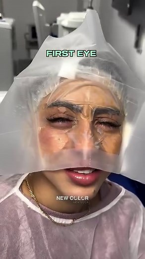 1.3M views · 6.1K reactions | Eye color change using the FLAAK Pro technique, the most advanced and natural keratopigmentation ☝ On the advice of New Color, our patient chose the Water Green color at the New Vision clinic in Nice  You dream about changing the color of your eyes ? Send us a PM  #newcolor #flaak #keratopigmentation #visumax #visumax800 #eye #eyecolorchange #water green #nice | New Color FLAAK | Facebook