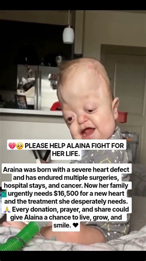 please donate link in bio #cancer #babies #donors #california #vegan #fypシ゚viral