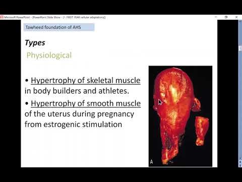 Pathology -CELLULAR ADAPTATIONS
