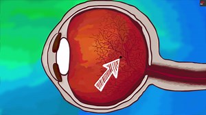 29K views · 439 reactions | Ever see something floating across your field of vision? Here's what you need to know about floaters: | TED | Facebook