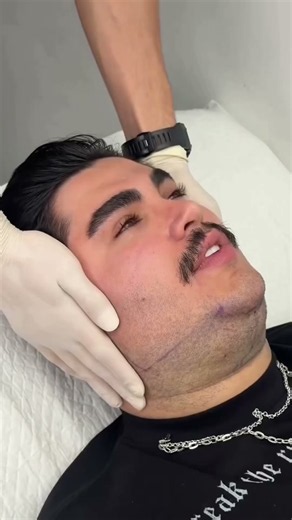 Say goodbye to your double chin.💕