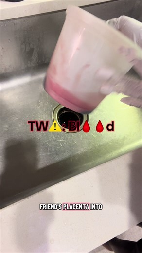 PLEASE KEEP SCROLLING IF YOU HAVE A WEAK STOMACH, THANKYA! I meant to say cut the umbilical cord before steaming* Placenta encapsulation (powdered) is used to help replenish nutrients lost during pregnancy and birth. The placenta contains iron, amino acids, hormones (like progesterone & estrogen), and trace minerals that may support: • Postpartum hormone regulation • Reduced risk of postpartum mood disorders • Energy restoration & fatigue support • Iron replenishment after blood loss • Lactation