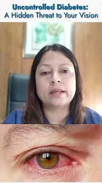 How Diabetes Affect Your Eyes? Diabetes & Vision Loss Explained | Dr. Archana Singh