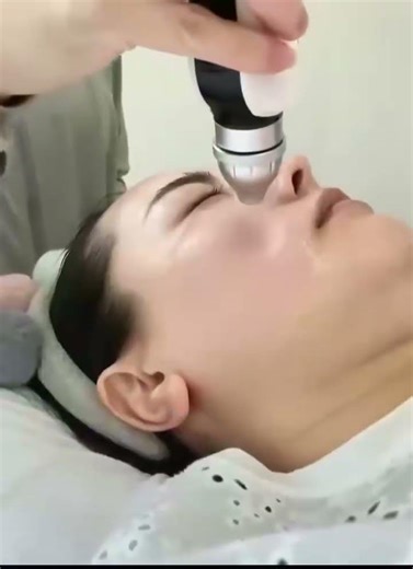 Oxygen jet peel skin rejuvenation face lift machine