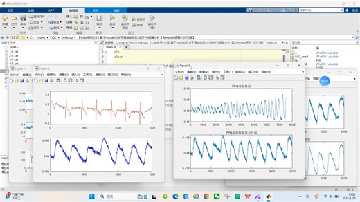 【心电信号ECG】基于matlab五点平滑滤波后ECG和PPG频谱分析【含Matlab源码 10970期】