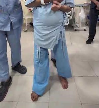 NPH gait (shuffling, wide-based, slow, short-stepped walk with Ataxia)