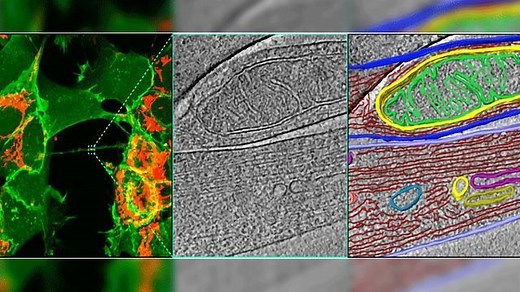 Incredible Tunneling Nanotubes Connect Neurons