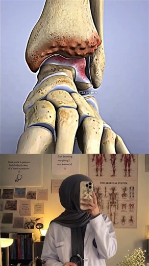 This Is How Ankle Replacement Works 😨🦶 #anklesurgery