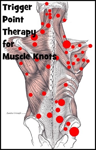 Effective Trigger Point Therapy for Muscle Knots