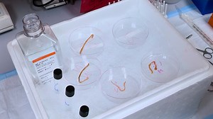 The Isolation of Flowing Mesenteric Lymph in Mice to Quantify In Vivo Kinetics of Dietary Lipid Absorption and Chylomicron Secretion