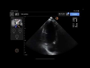 Handheld Ultrasound Review: KOSMOS by Echonous