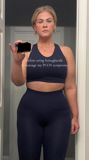 PCOS Weight Loss Journey: 12 Weeks on Semaglutide & WeightCare