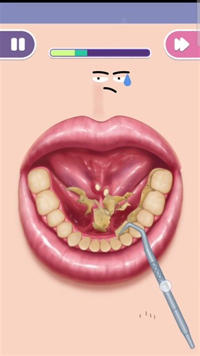 Dirty Teeth Cleaning ASMR Game 🤢➡️✨ Super Satisfying