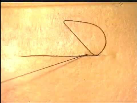 5.5. Sub-cuticular Suture (The Invisible Suture) [Basic Surgery Skills]
