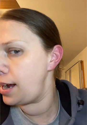 Understanding Red Ear Syndrome and Its Triggers