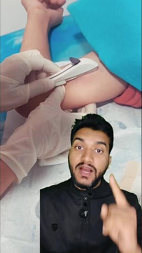 Etonogestrel Implant