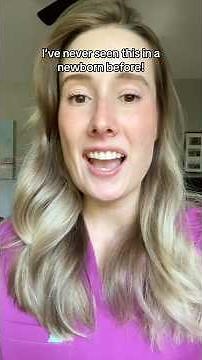 The Harlequin Color Change! #newborn #pregnant #birth #momtobe #nurse #parents #laboranddelivery