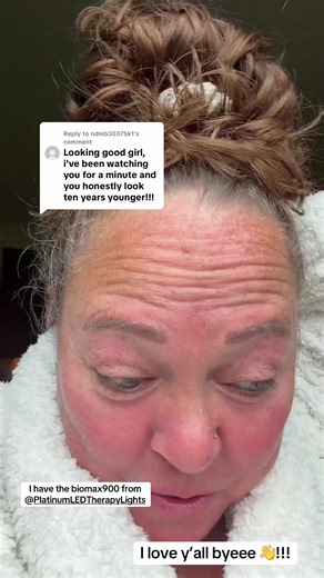 Replying to @ndmb30375k1 | platinum led therapy lights