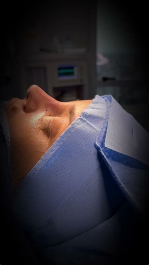Male Rhinoplasty - Dr. Gabriel Gontigio