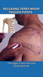 Releasing Teres Minor Trigger Points 👉 The teres minor is one of the four muscles that make up the rotator cuff in the shoulder joint. It plays a vital role in stabilizing the joint and enabling external rotation of the arm. 👉 The teres minor muscle can develop trigger points due to overuse, repetitive movements, poor posture, or direct trauma to the shoulder area. 👉 Treatment for trigger points in the teres minor may involve manual therapies such as trigger point release, massage, and stretc