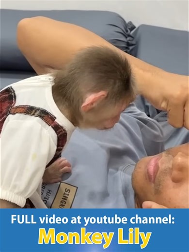 Monkey Doctor Helps Relieve Fever in Fun TikTok Moment