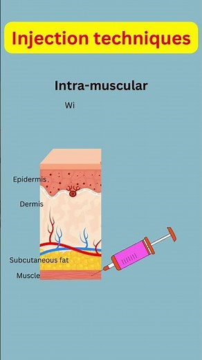 Injection 💉