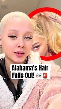 Alabama’s Hair Falls Out! #shorts #alabamabarker #hairdamage