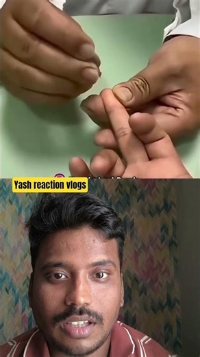 Blood Test - A Comedy#comedy #viral #eyecatchy #doctor #crazy