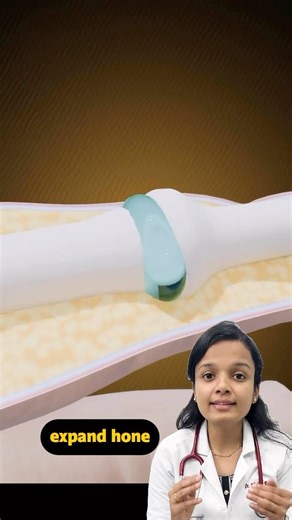 Finger Cracking & Popping Sound Explained | Medical Truth #finger