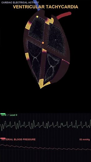 Cardiac Simulation