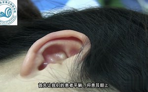 How to use Ear Drop correctly？如何正确使用滴耳液呢？