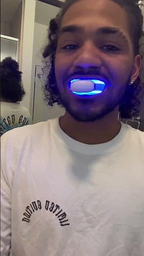 Teeth Whitening Review – Honest Thoughts & Results