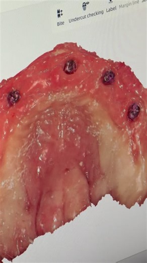 Luke Kahng on Instagram: "Received Photogrammetry from @shining3ddental Dr.Robert Mcgonigle in Illinois"