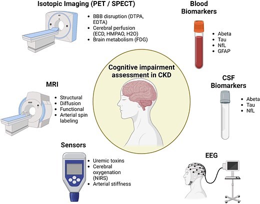 Cognitive impairment in chronic kidney disease: role of brain imaging, functional imaging, electroencephalography, cerebrospinal fluid biomarkers and sensors