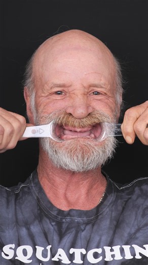 5.8K views · 34 reactions | Here's What He Did To Replace His Dentures For GOOD... 勞醴 #makeover #dentures #dentalimplants #confidence #teeth #slc | Nuvia Dental Implant Center | Facebook