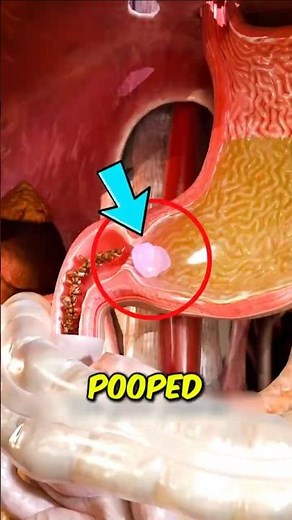 What Happens To Your Body When You Swallow Gum 😱